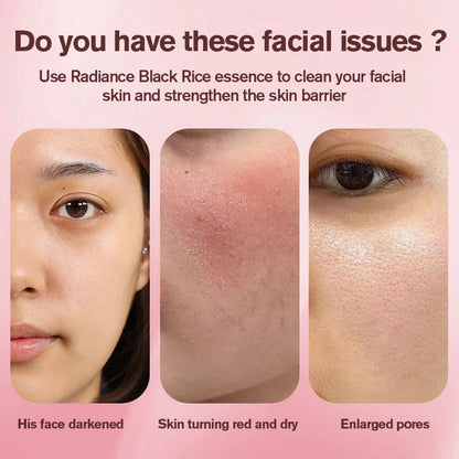 Dr. Melaxin – Peel Shot Exfoliating Black Rice Ampoule