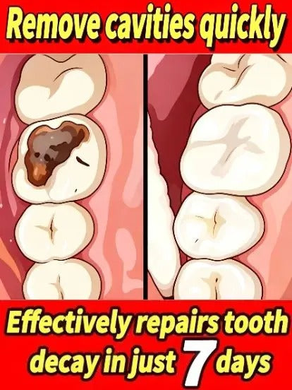7.5% Nano Hydroxyapatite Fluoride Toothpaste for Teeth Whitening